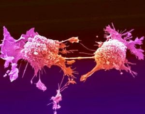 tumori a cellule germinali
